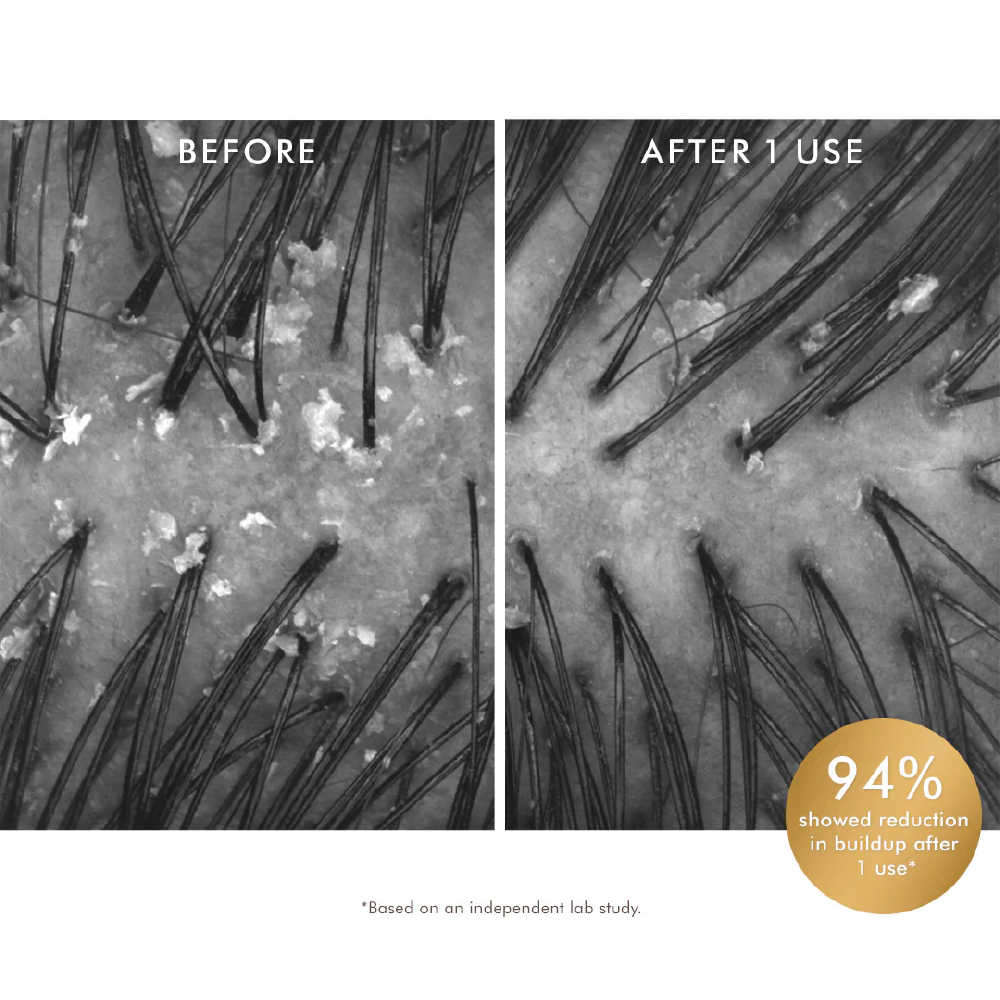 MOROCCANOIL SCALP PURIFYING SCRUB 125ML